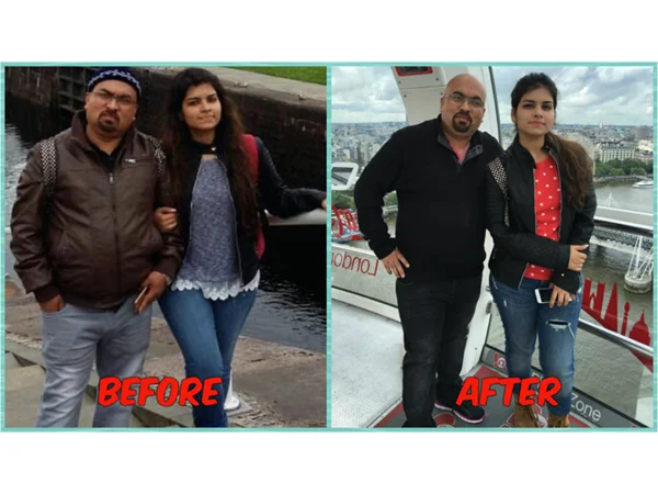 Before and After