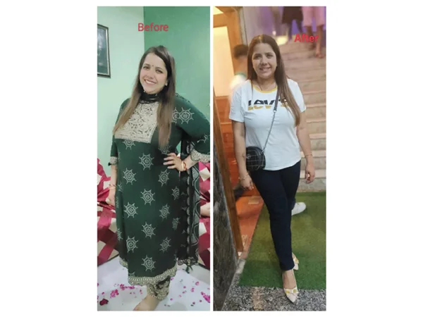 Before and After