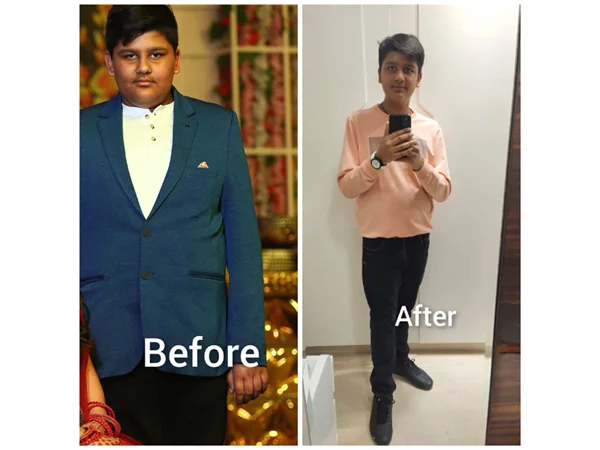 Before and After