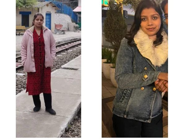 Before and After