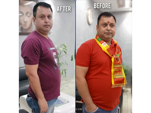 Before and After
