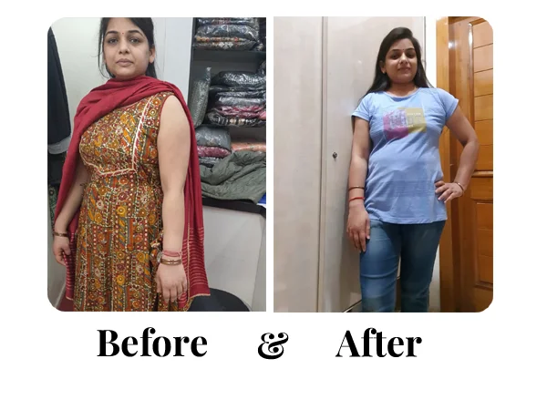 Before and After