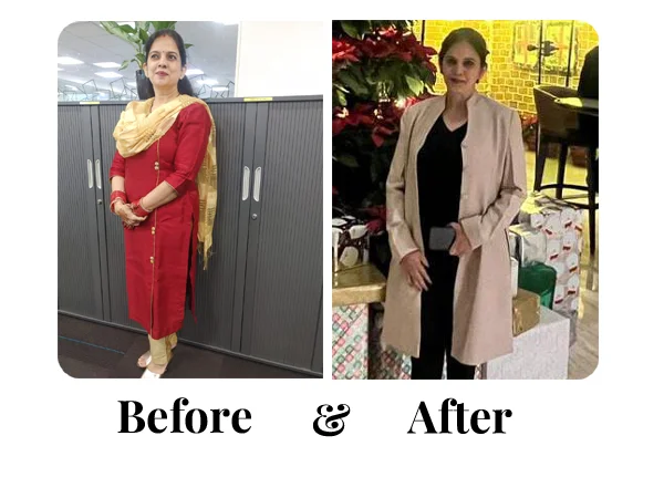 Before and After