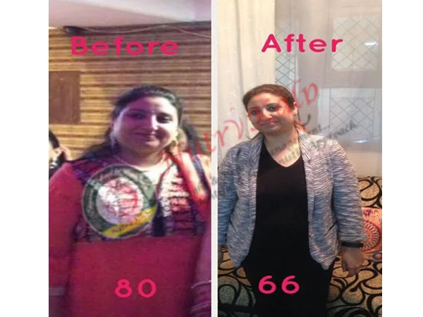 Before and After