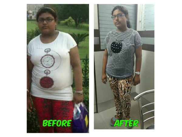 Before and After