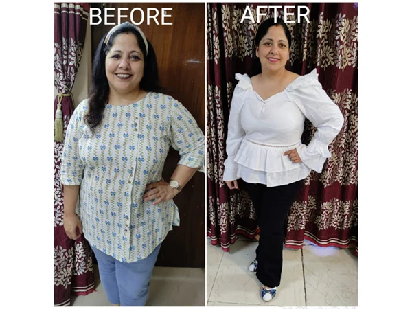 Before and After