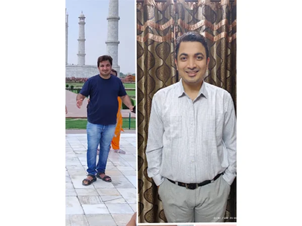 Before and After