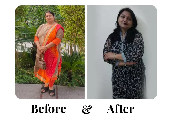 Before and After