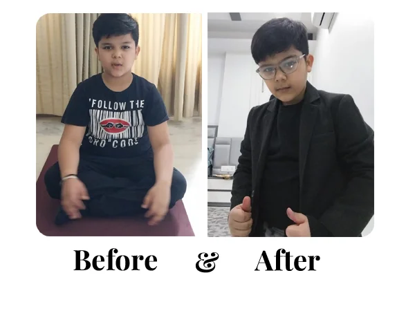 Before and After