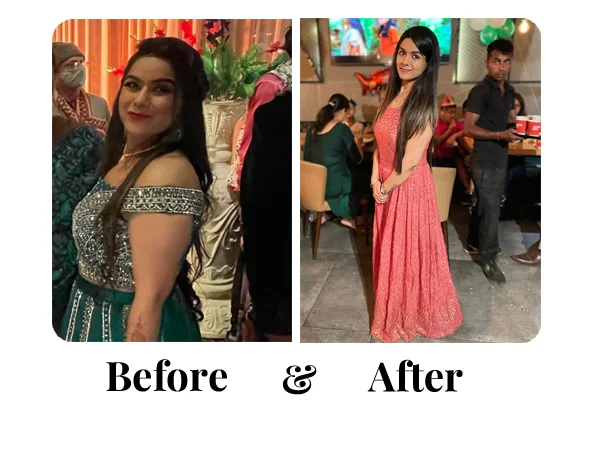 Before and After