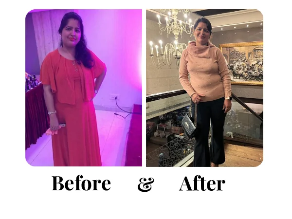 Before and After