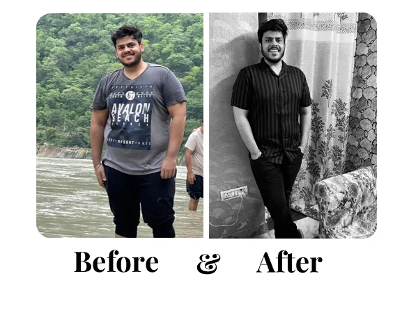 Before and After