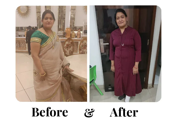 Before and After