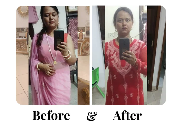 Before and After