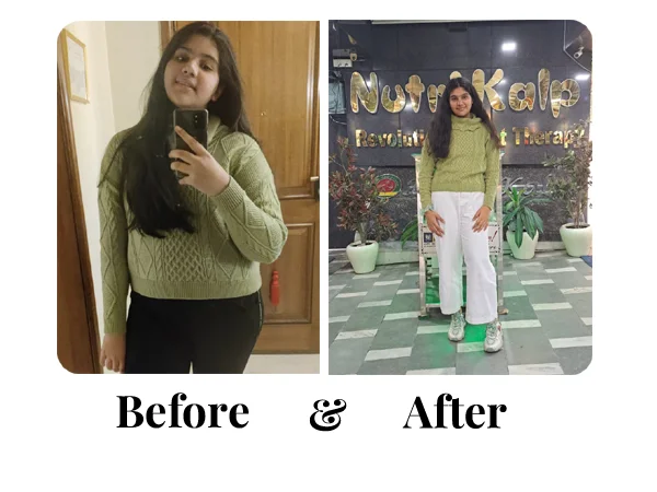 Before and After