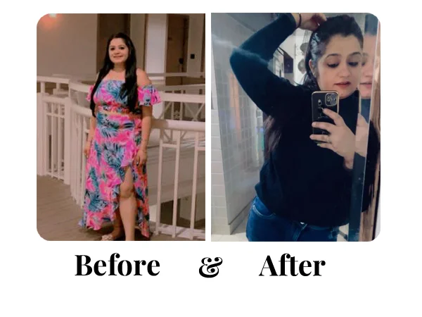 Before and After