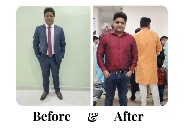 Before and After
