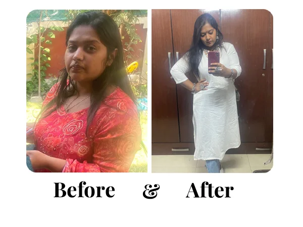 Before and After