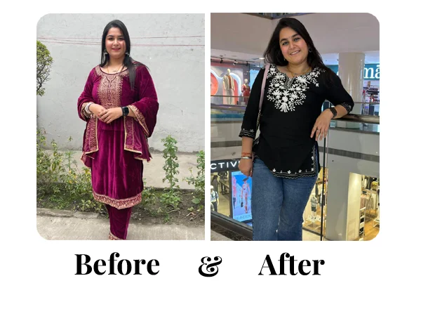 Before and After