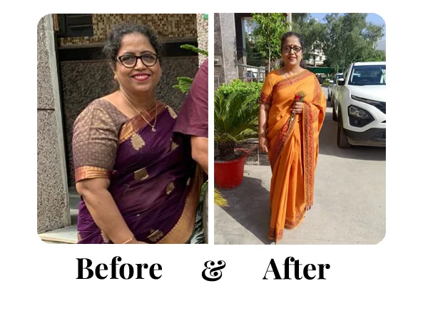 Before and After