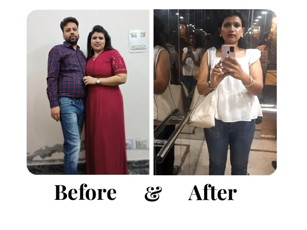 Before and After