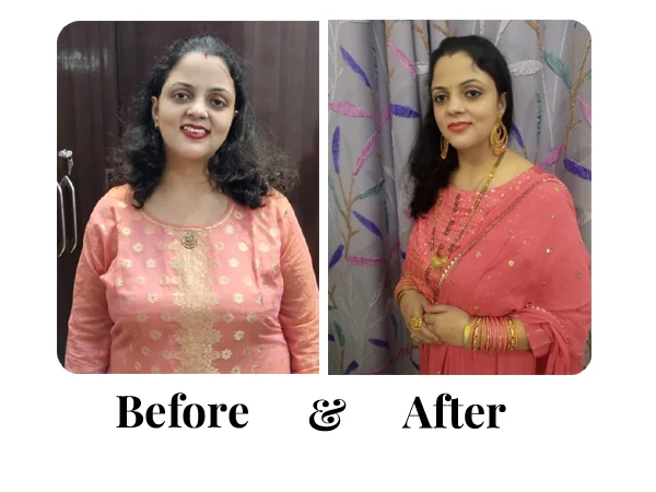 Before and After