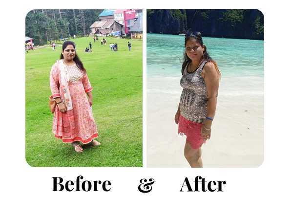 Before and After