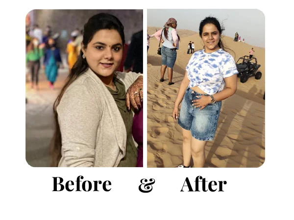 Before and After