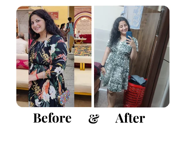 Before and After