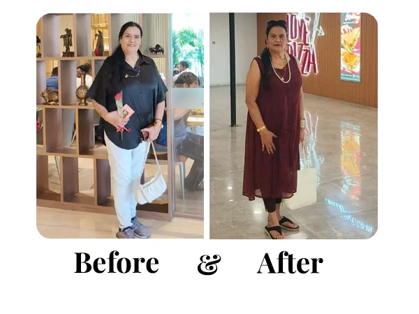 Before and After