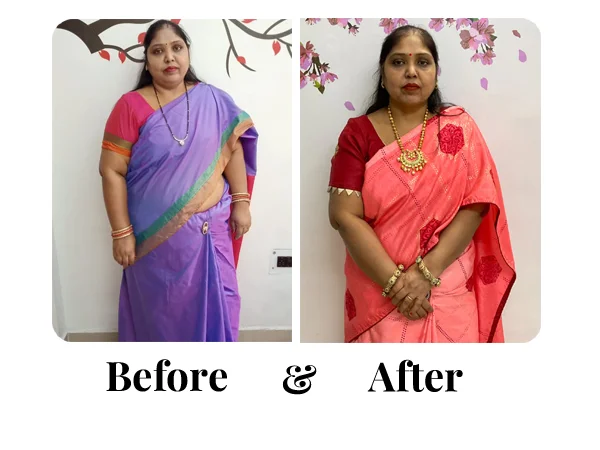 Before and After